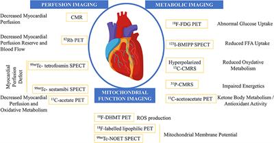 New Insights in Early Detection of Anticancer Drug-Related Cardiotoxicity Using Perfusion and Metabolic Imaging